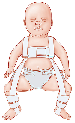 Infant in a harness.